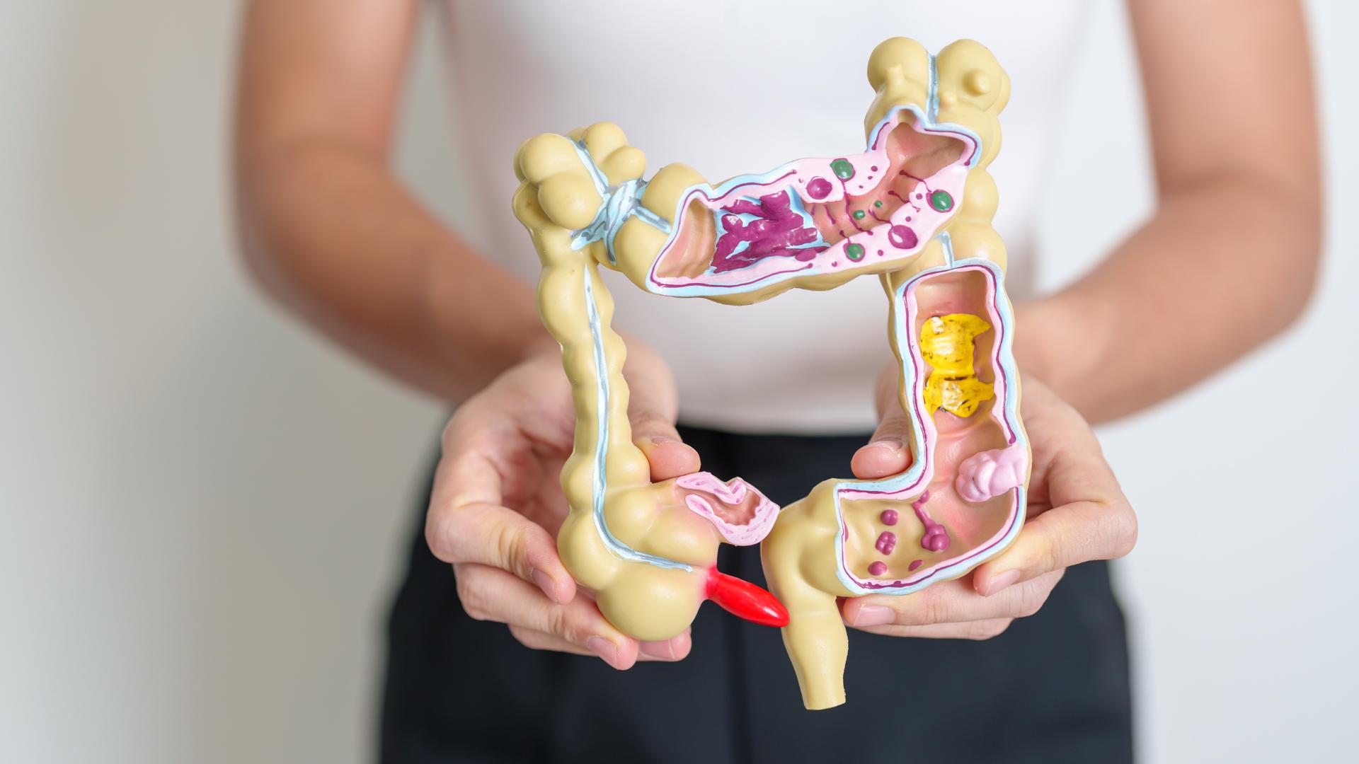 Tratamento da síndrome do intestino irritável